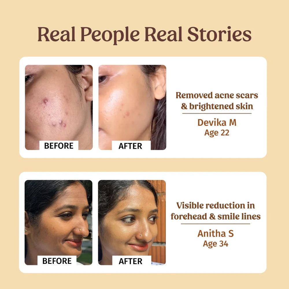 AM PM Serum Kit - Vilvah