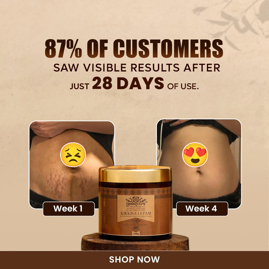 Kikkisa Lepam | Anti-Stretch Marks Cream (100g) - YadaSutra