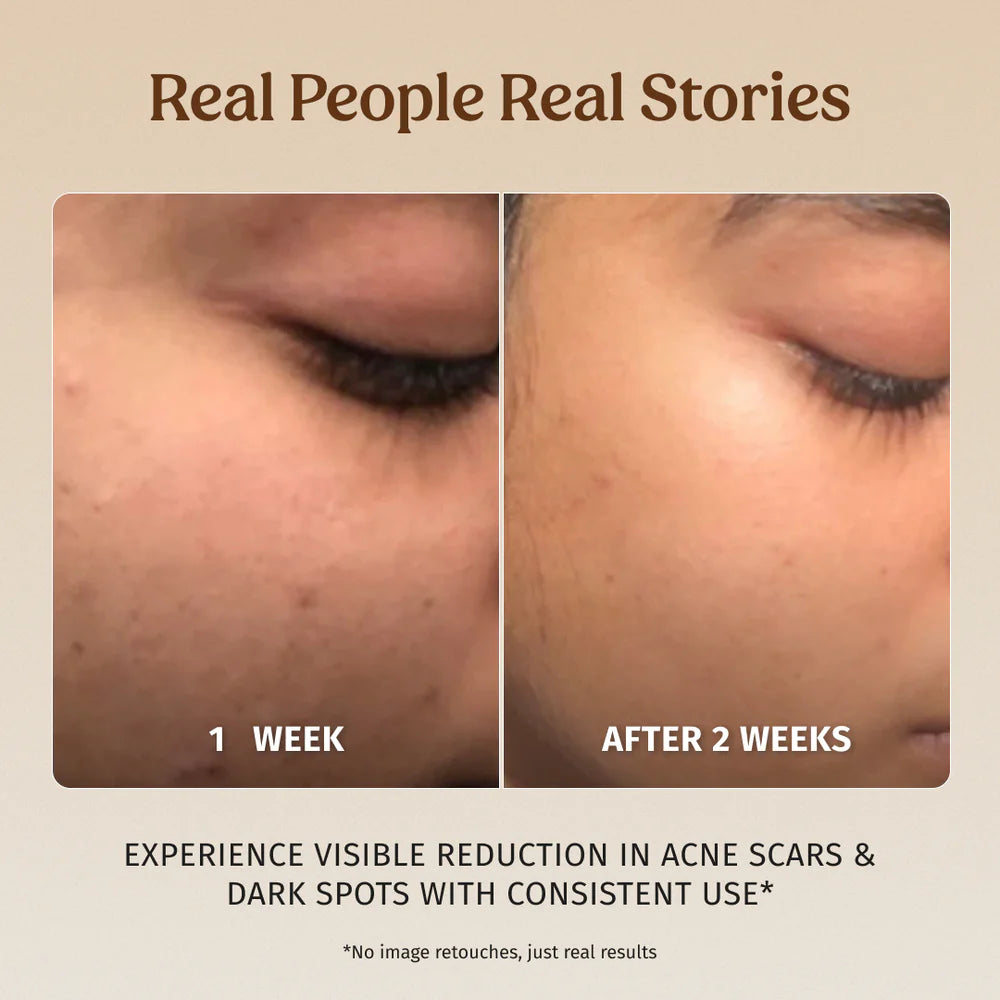 Face Brightening Kit - Vilvah