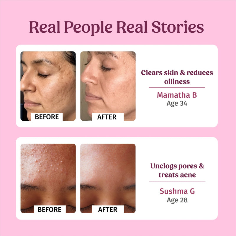 Rosewater Facial Toner (Hydration) - Vilvah