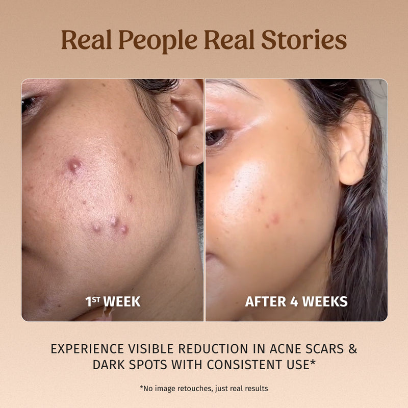 Milk Drops Brightening Serum (Skin Brightening) - Vilvah