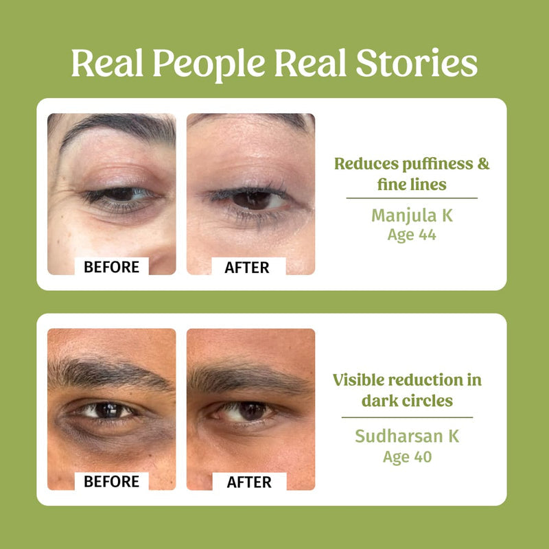 Under eye cream (Dark Circle Control) - Vilvah